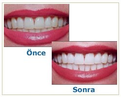 Slider image (8) Dentist Alanya